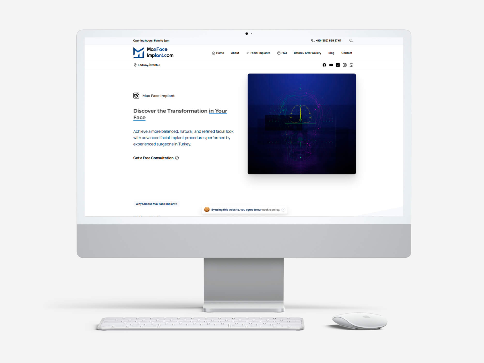 Max Face Implant web sitesi